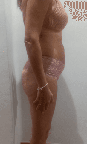 Belén — antes